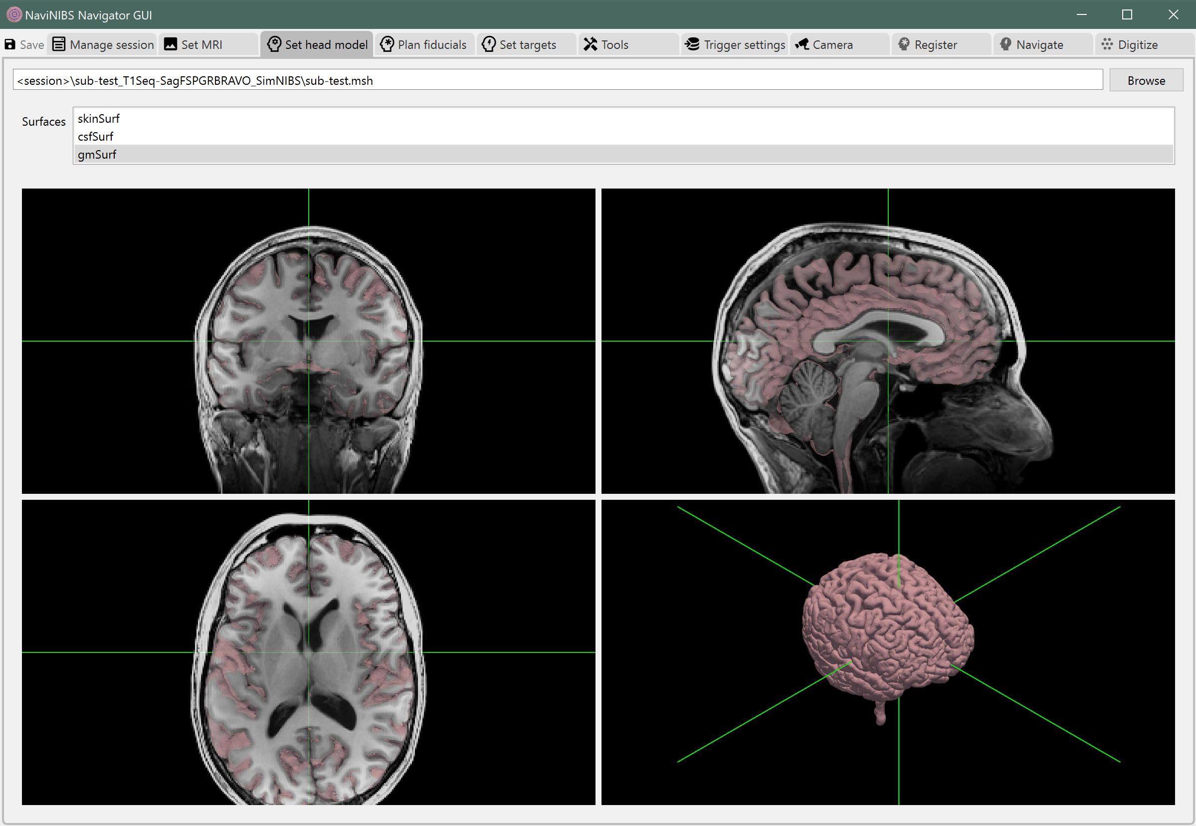 NaviNIBS head model tab