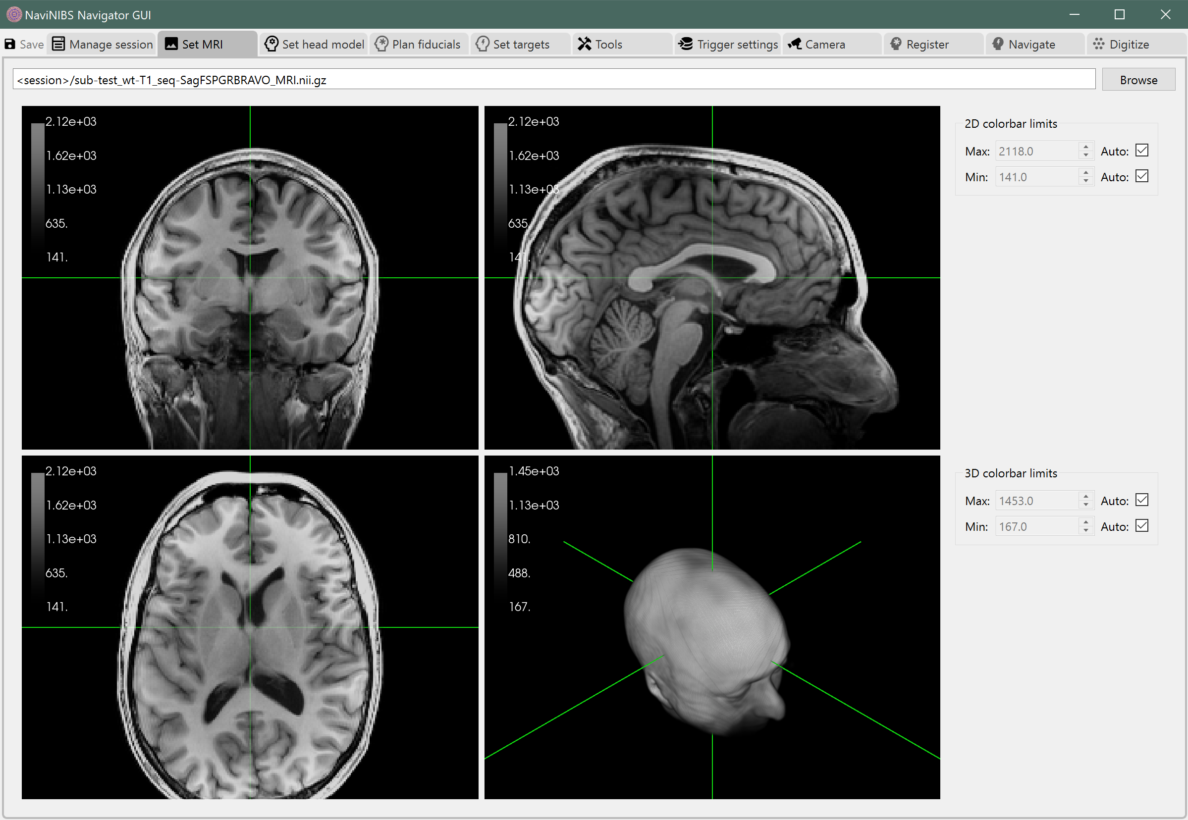 NaviNIBS MRI tab